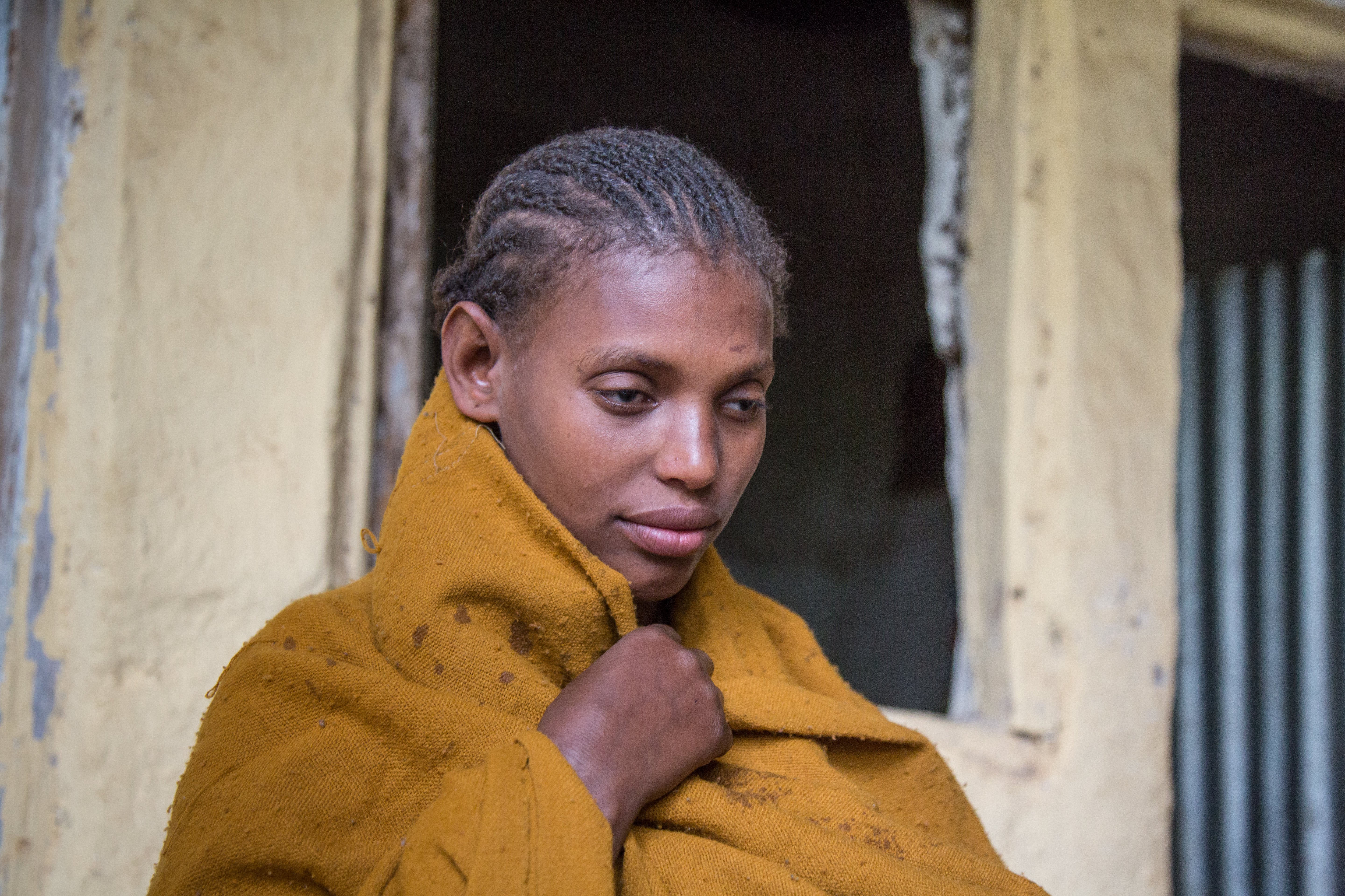 An adolescent girl who is blind in Amhara, Ethiopia